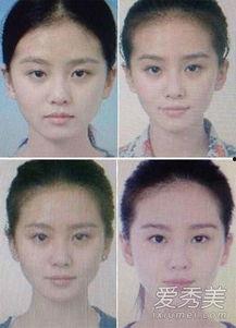 黑眼圈重的女明星,揭秘重黑眼圈女明星的美丽秘诀