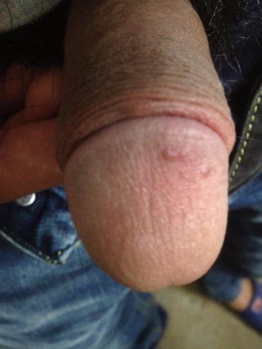 男明星龟头,揭秘男明星的私密之美